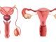 18497443 newstudyconfirmsmicroplasticsandnanoplasticsharmhumanreproductivehealth2 jpegb68f3a1a663b54752bf2bfd4039a6298