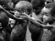 Malnurished children 1024x577 1