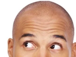 5 genius ways to hide a bald patch 7 5 genius ways to hide a bald patch