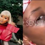 Cyan Boujee Shows Bruised Face, Claims Abuse by Boyfriend (Video)