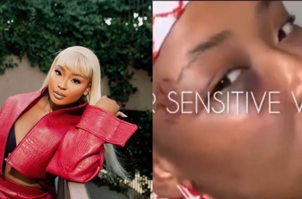 Cyan Boujee Shows Bruised Face, Claims Abuse by Boyfriend (Video)