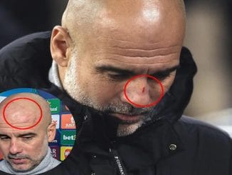 Guardiola Clarifies Self-Harm Comments After Post-Match Joke About Scratches on His Face