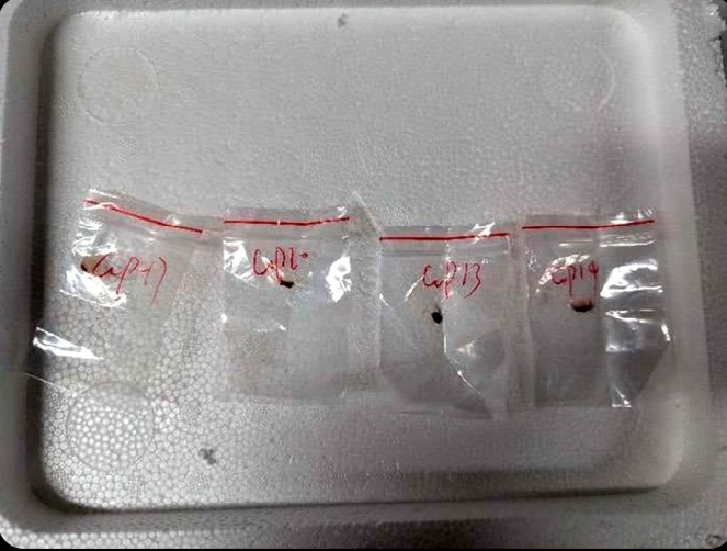 Chinese Nationals Accused Of Smuggling ‘Dangerous Biological Pathogen’ Into US